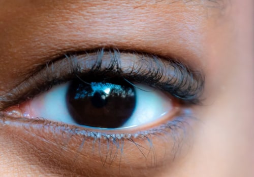 Why use eyelid wipes?