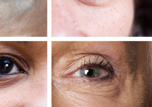 Do eyelid pads work?
