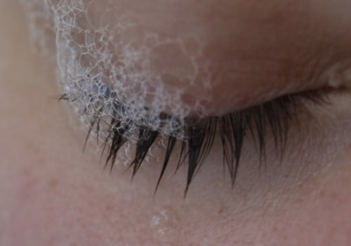 Should you wash your eyelids with soap?